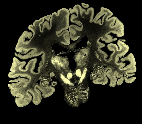 computer generated image