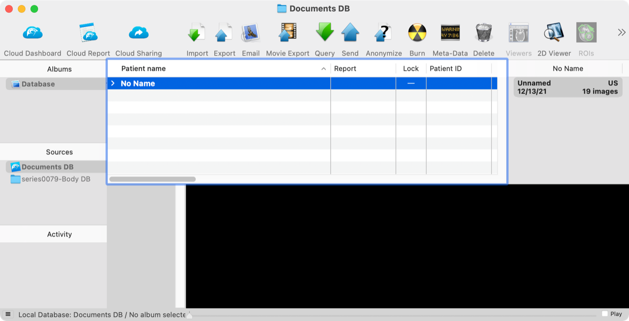 Added by email2trac Added by email2trac